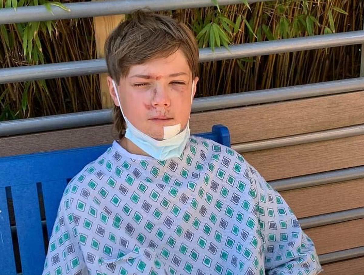 Three days after being struck by a car while bicycling, 13-year-old Drew Farabaugh gets some fresh air on his hospital room balcony. Photo via Facebook.